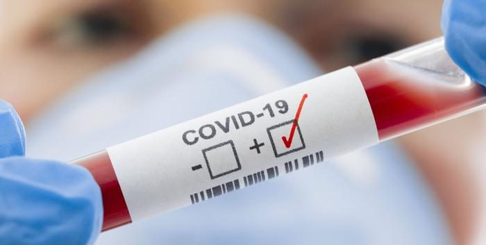 Статистика заболеваемости COVID-19 на 16.06.2021 Статистика заболеваемости COVID-19 на 16.06.2021